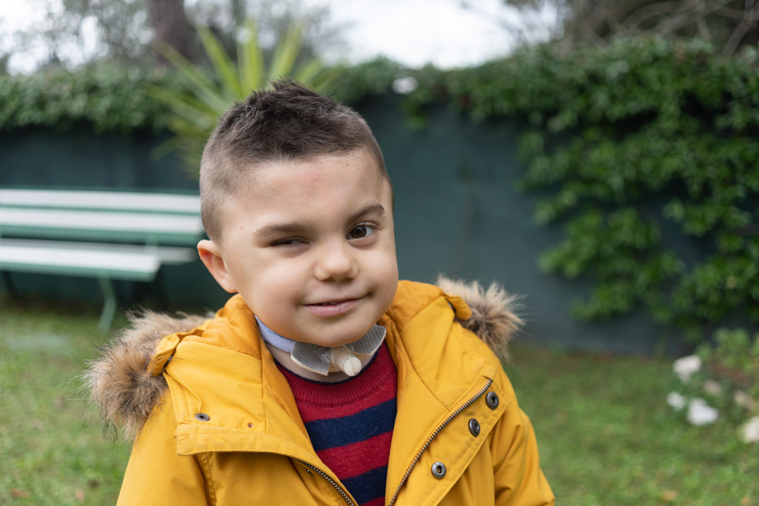 Primo piano di Leonardo, bambino con sindrome di Charge, protagonista dello spot per la campagna della donazioni regolari