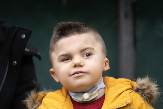 Ritratto di Leonardo, bambino affetto dalla sindrome di Charge, seguito dalla Lega del Filo d'Oro. Foto in primo piano. 