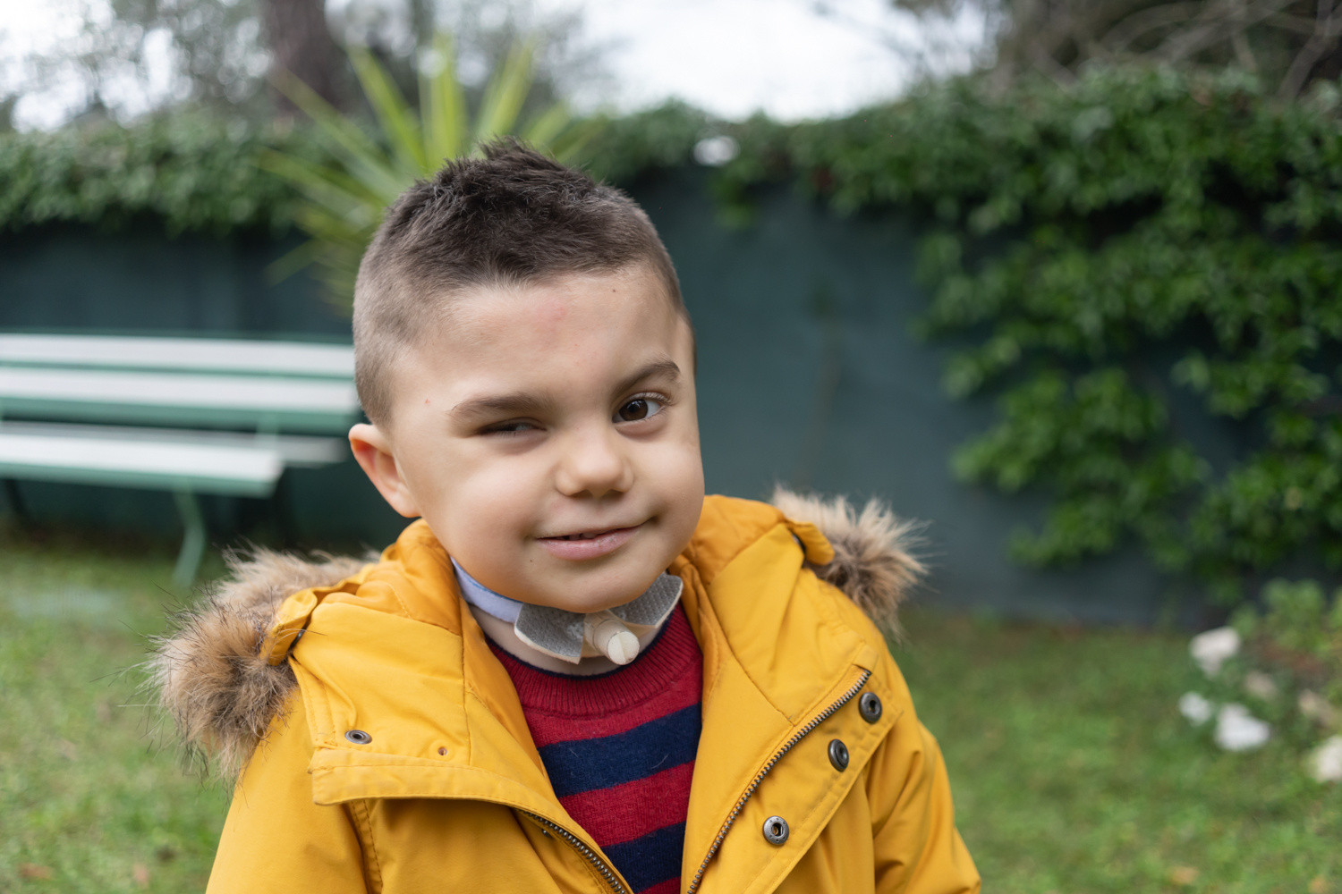 Primo piano sorridente di Leonardo, bambino con sindrome di Charge, in un parco con indosso un cappottino giallo