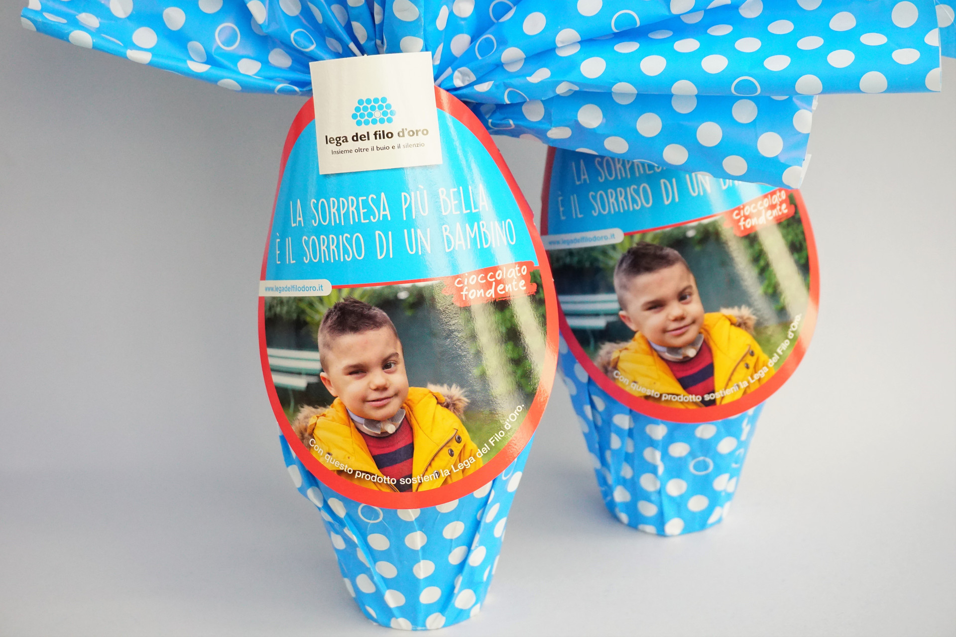 Due uova solidaLI con cofnezione azzurra e pois bianchi con foto di Leonardo, bambino con sindrome di Charge accolto dalla lega del filo d'oro